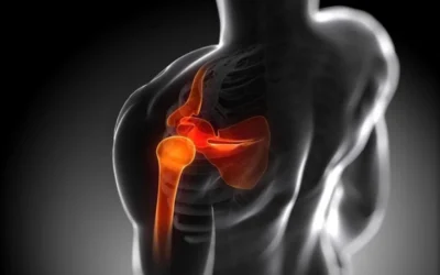 Lesiones en el CrossFit